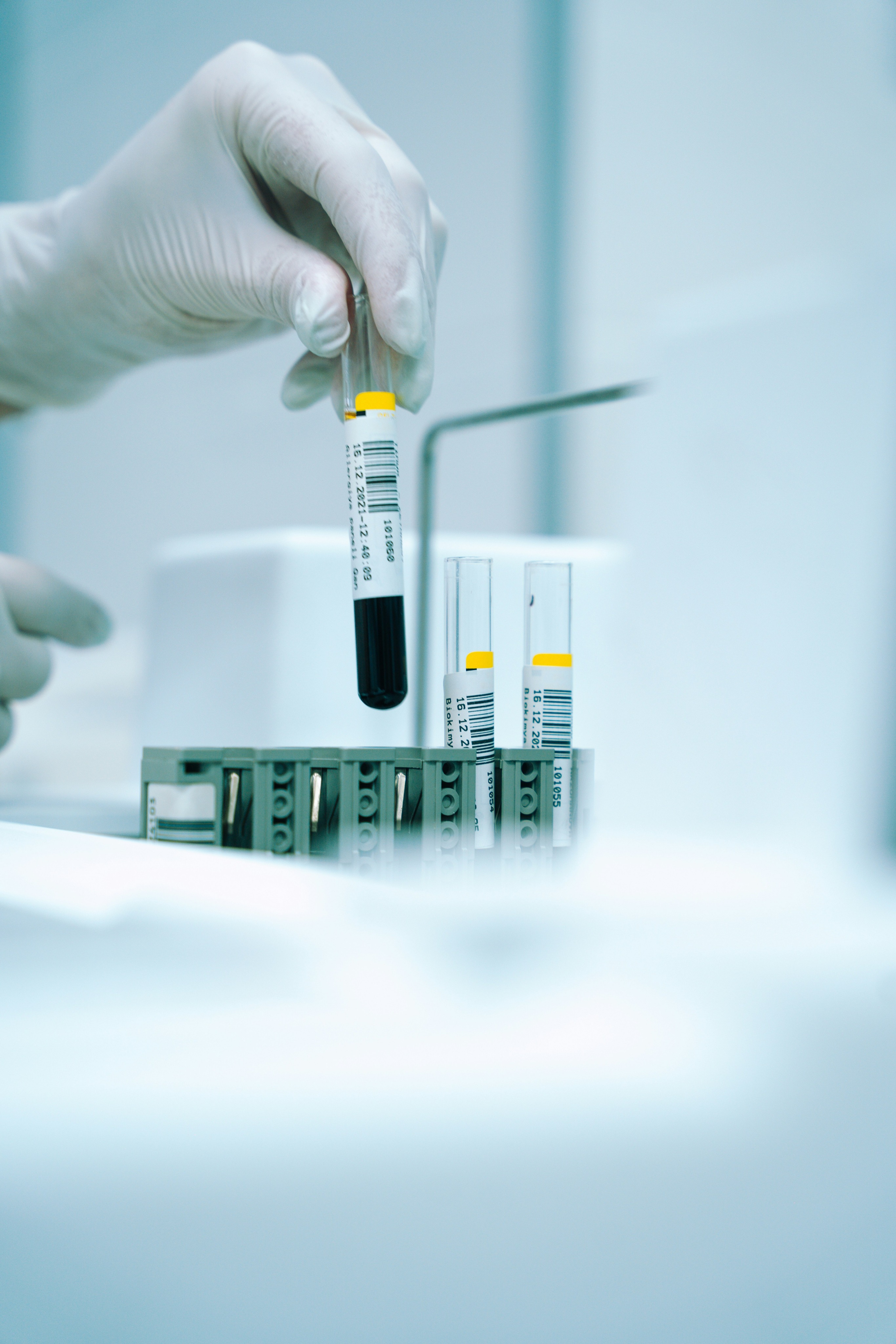 Scientist handling a clinical sample in a laboratory